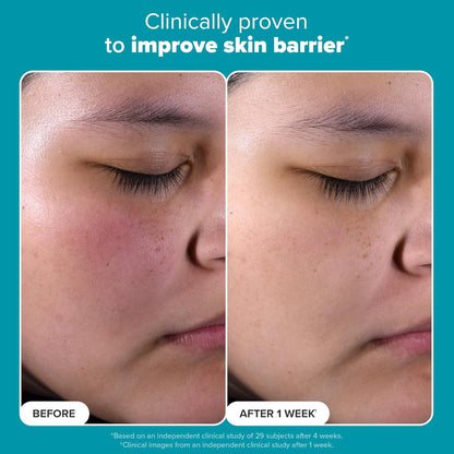 Paula's Choice 2% BHA Exfoliating Toner